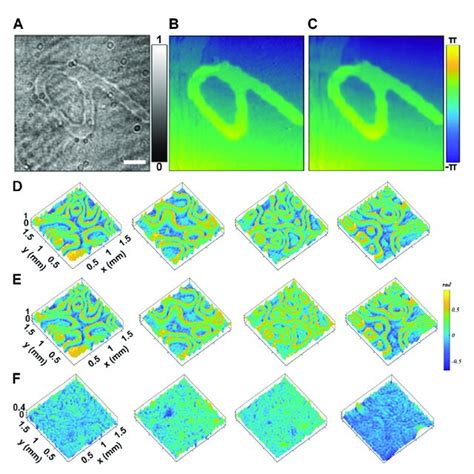 quantitative phase sampling|quantitative phase imaging pdf.